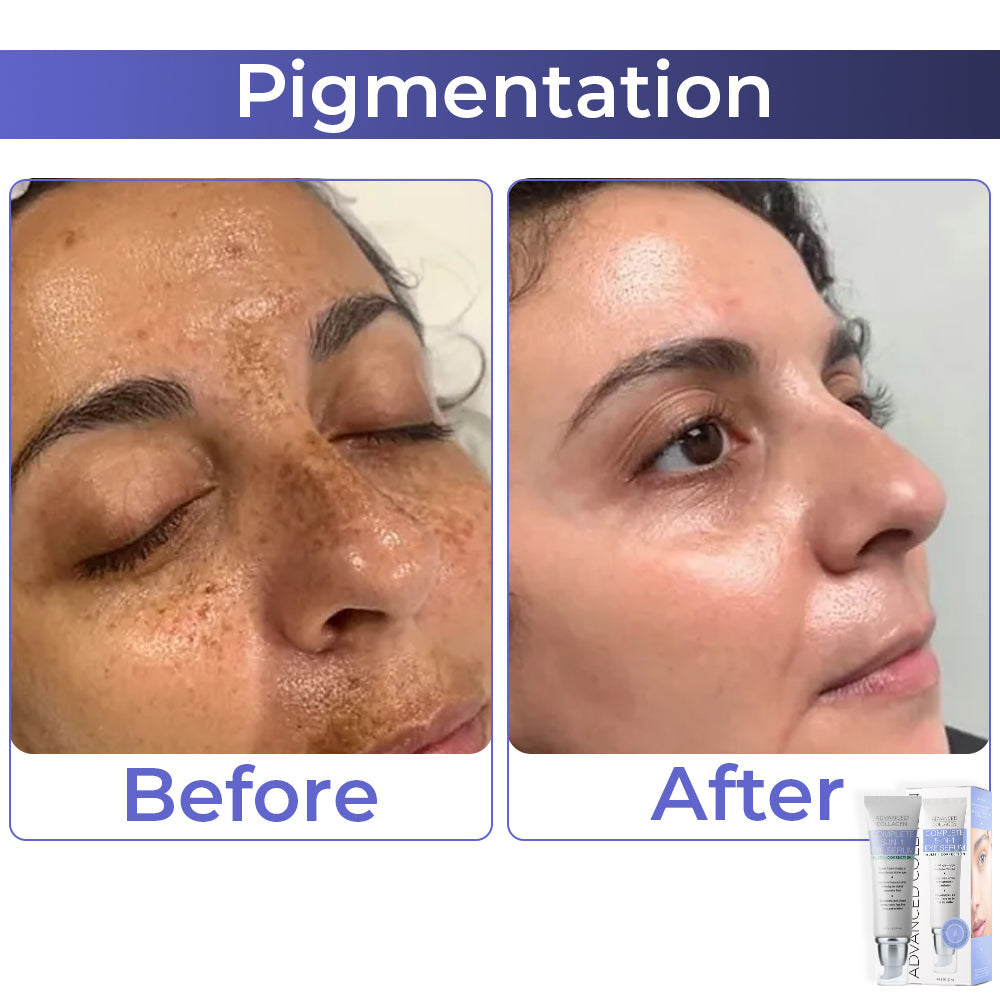 JEREMYTIS™ Advanced Collagen Complete Eye Cream